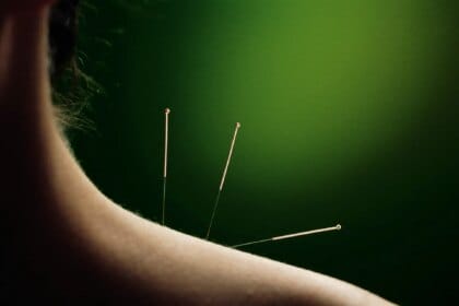 Les secrets de l'acupuncture pour une peau éclatante et saine