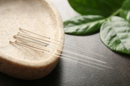 Qu'est-ce que l'acupuncture peut faire pour vous ?