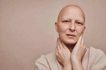 Comment accompagner ma chute de cheveux due au cancer : les gestes à adopter