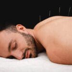 Les bienfaits de l'acupuncture sur la santé : guide complet