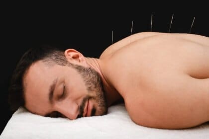 Les bienfaits de l'acupuncture sur la santé : guide complet