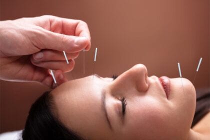 Les bienfaits du lifting énergétique et de l'acupuncture pour une guérison naturelle