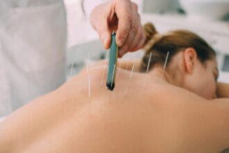 Acupuncture et méridiens : guide complet des principes de base